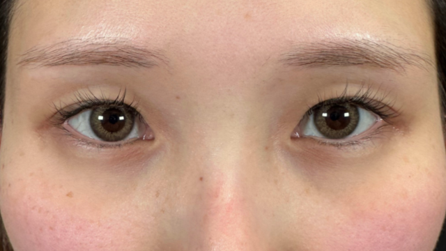 手术前的状态 其一