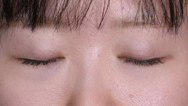 手术前的状态 其一