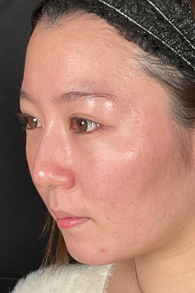 手術前の状態 その1