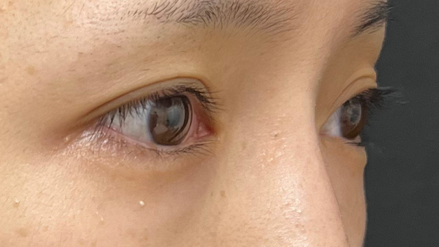 Postoperative Condition Part 1