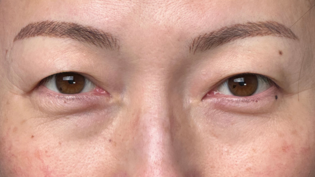 手术前的状态 其一