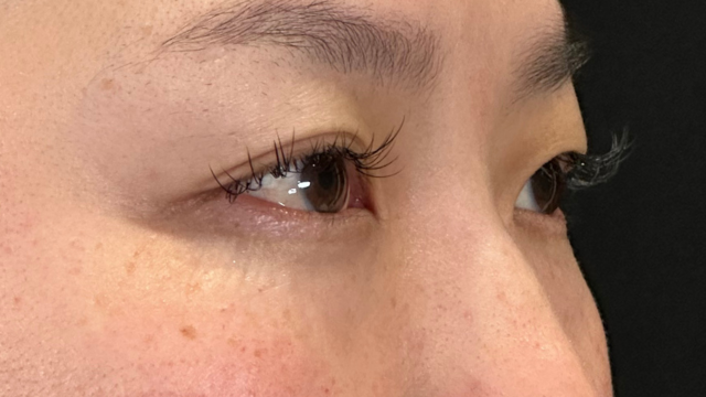 手术前的状态 其一