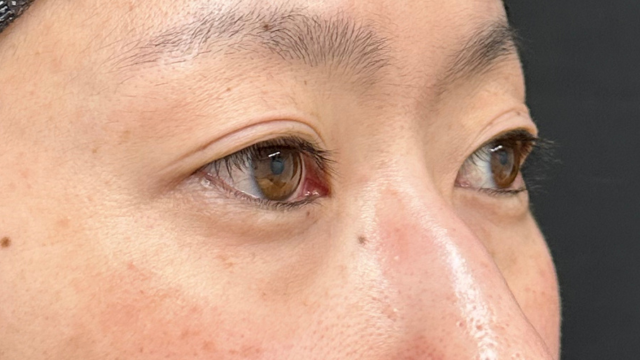 手术前的状态 其一