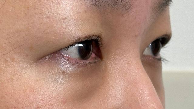 Postoperative Condition Part 1