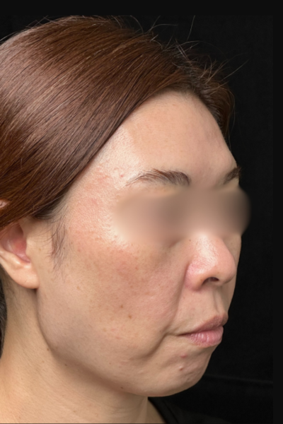 手術前の状態 その1