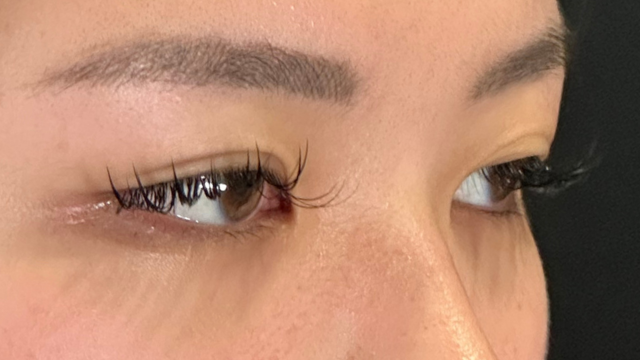 手術前の状態 その1