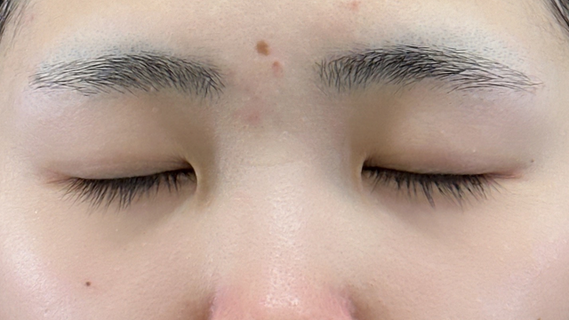 Postoperative Condition Part 1