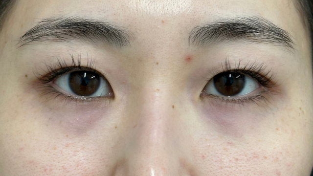 手术前的状态 其一