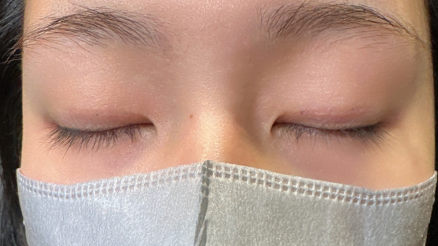 手术前的状态 其一