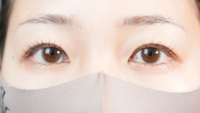 手術前の状態 その1