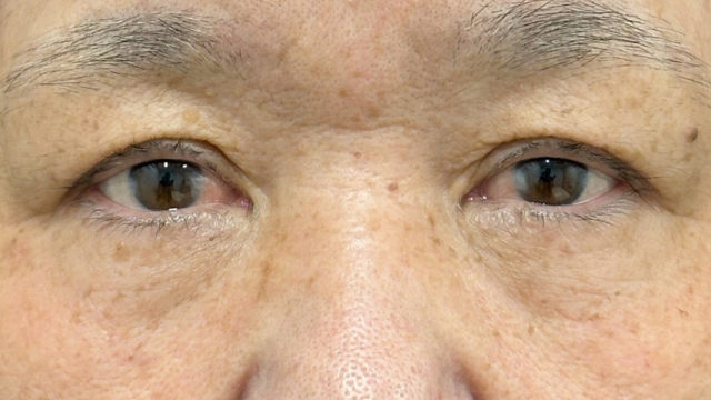 手术前的状态 其一