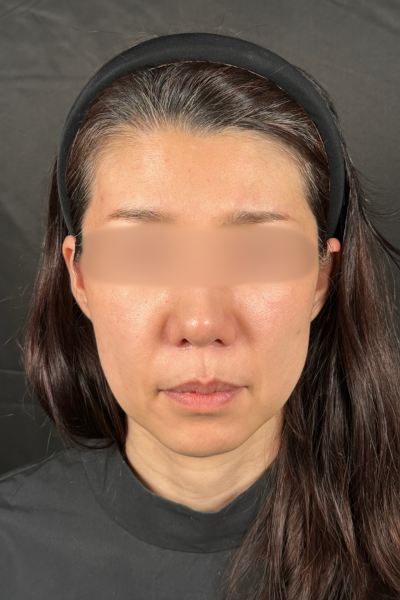 Postoperative Condition Part 1