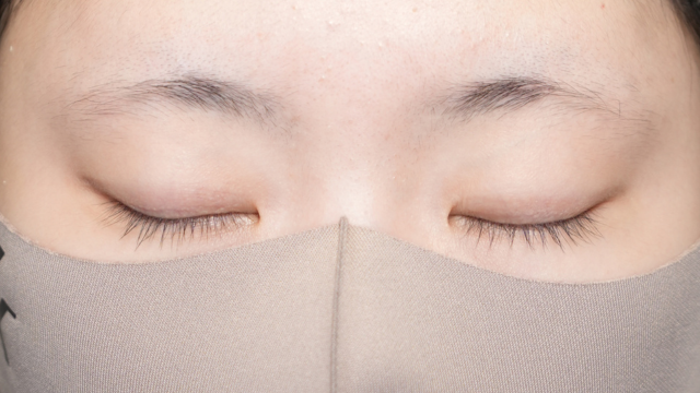 手术前的状态 其一