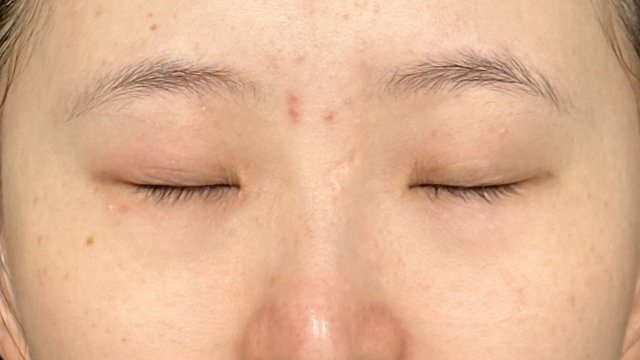 Postoperative Condition Part 1