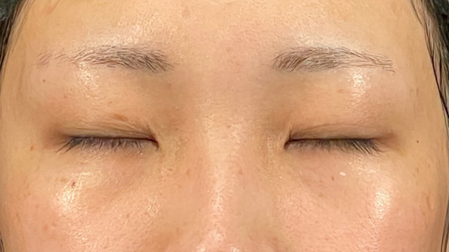 手術前の状態 その1