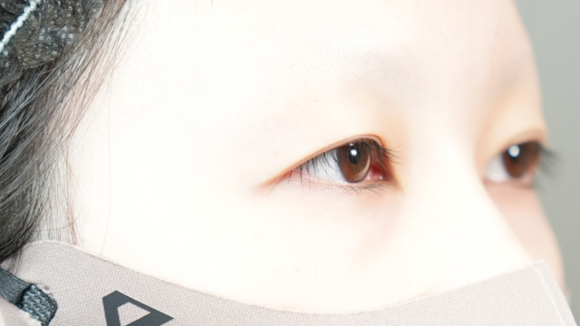 Postoperative Condition Part 1