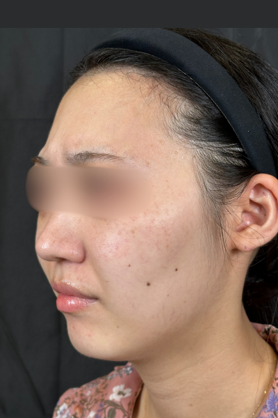 手術前の状態 その1