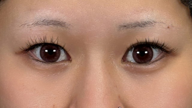 手术前的状态 其一