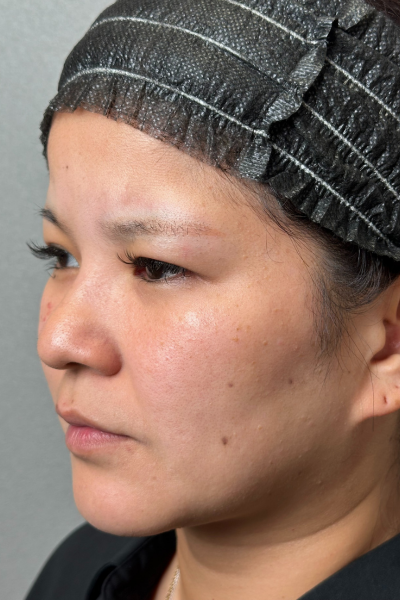 Postoperative Condition Part 1