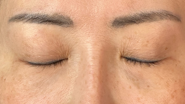 Postoperative Condition Part 1