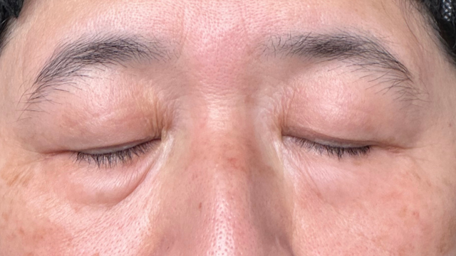 Postoperative Condition Part 1