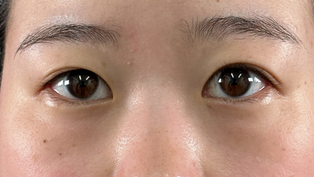 Postoperative Condition Part 1