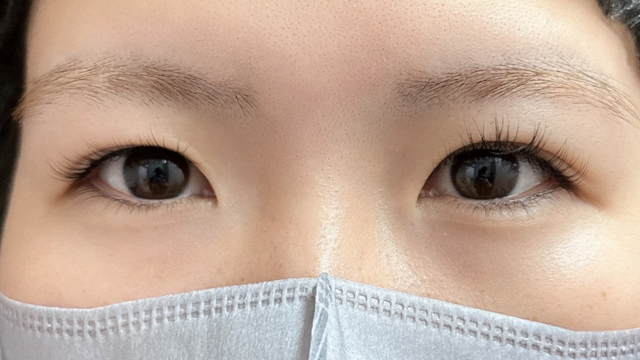 手术前的状态 其一