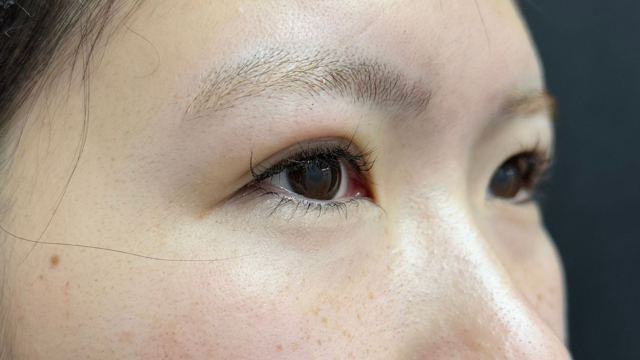 手术前的状态 其一