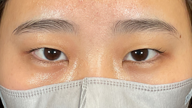 手术前的状态 其一