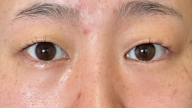 手术前的状态 其一