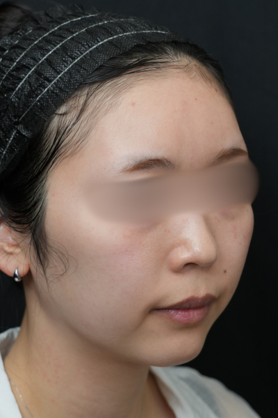 Postoperative Condition Part 1