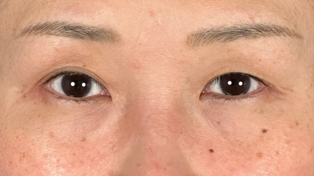 手术前的状态 其一