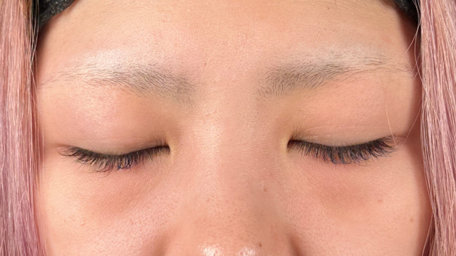 手术前的状态 其一