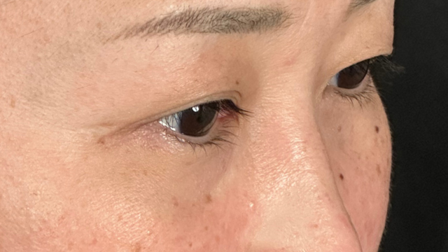 手术前的状态 其一