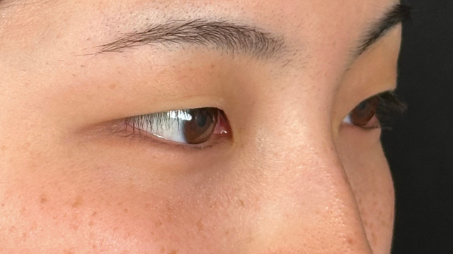 手术前的状态 其一