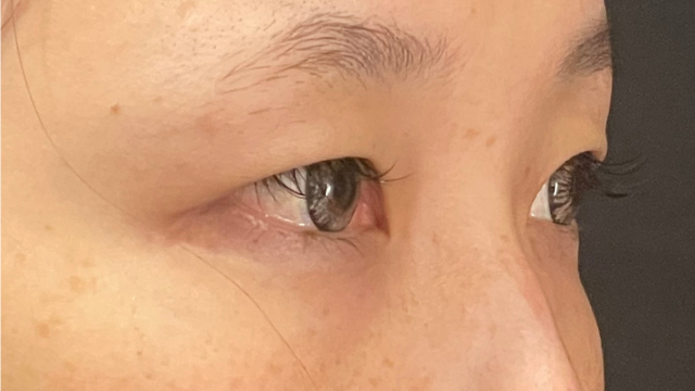 手术前的状态 其一