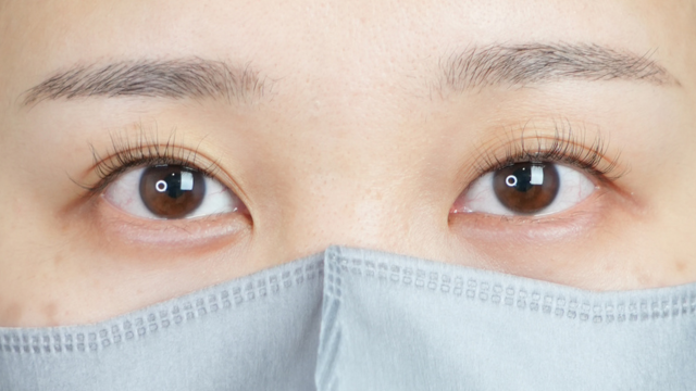 手術前の状態 その1