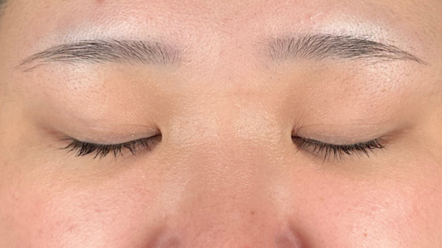 手术前的状态 其一