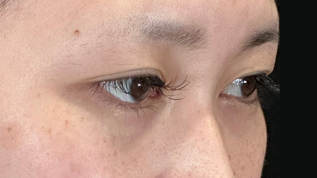 Postoperative Condition Part 1