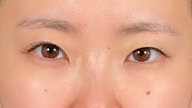 Postoperative Condition Part 1