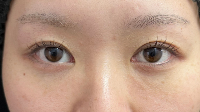 手术前的状态 其一