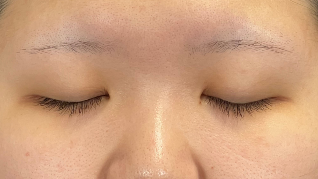 手术前的状态 其一