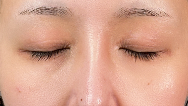 手術前の状態 その1