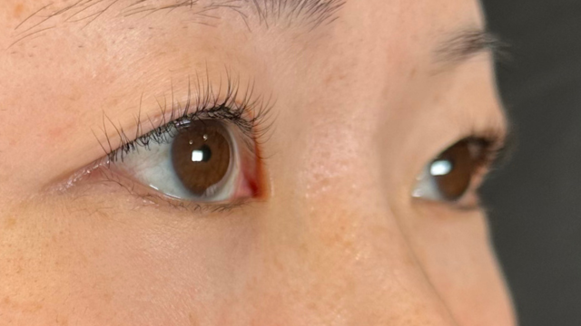 手术前的状态 其一