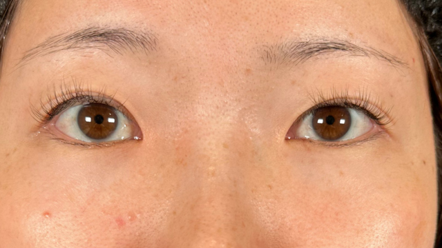 手术前的状态 其一