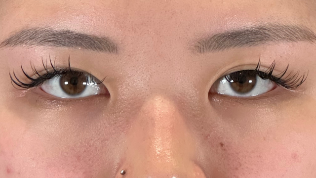 手術前の状態 その1