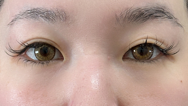 Postoperative Condition Part 1