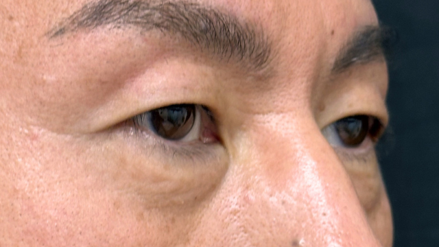 手术前的状态 其一