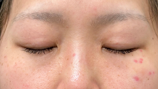 手术前的状态 其一