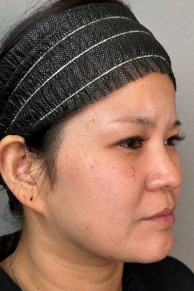 Postoperative Condition Part 1